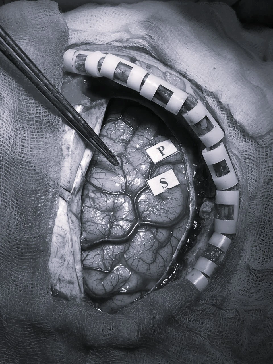 Imagen representativa de tratamientos cerebrales